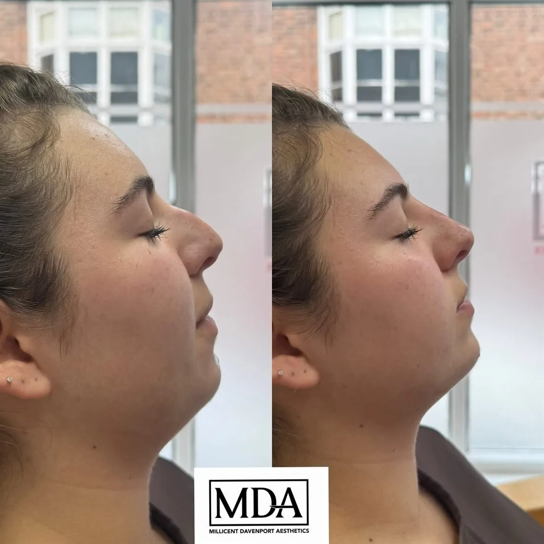 Treatment result 4