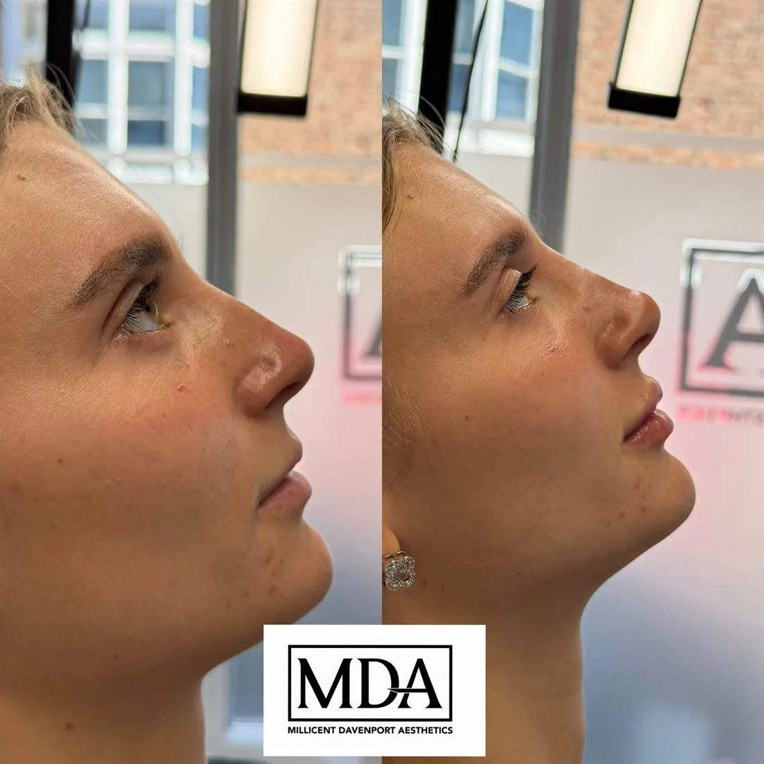 Treatment result 5