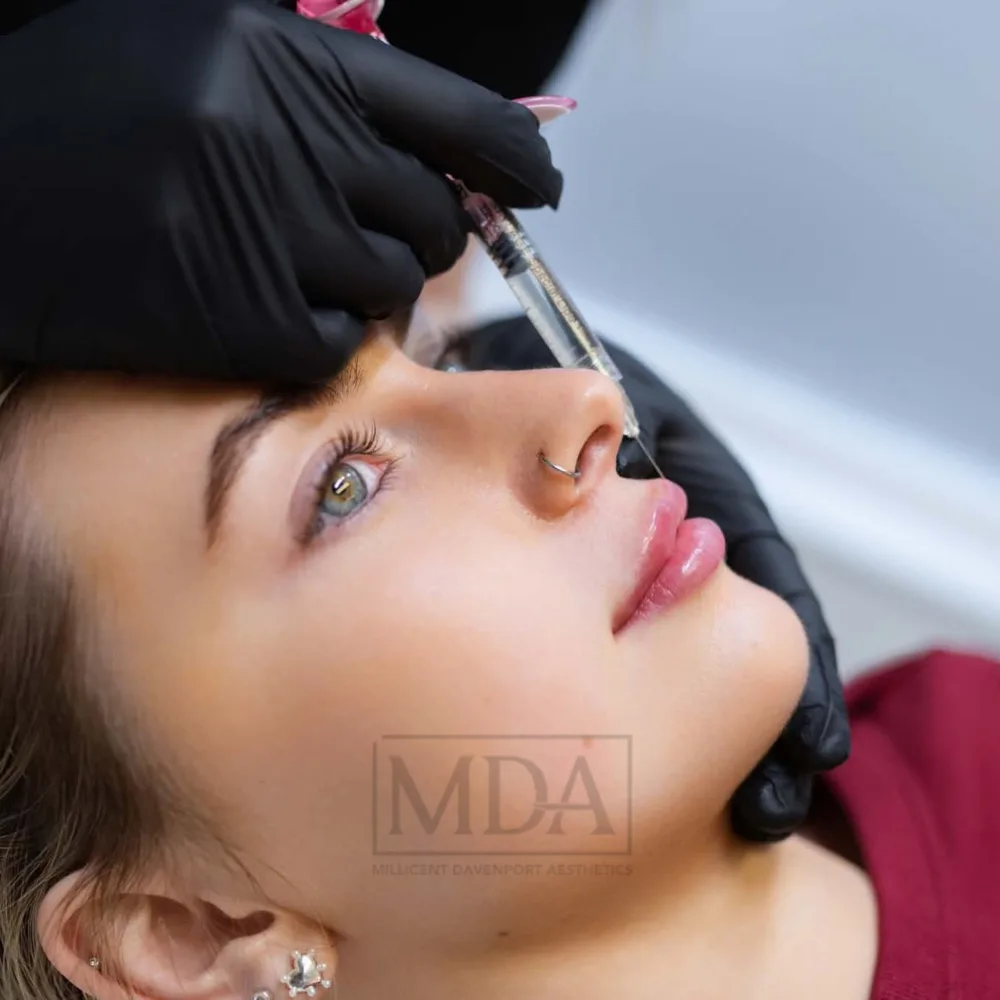 Lip enhancement being carried out at the clinic